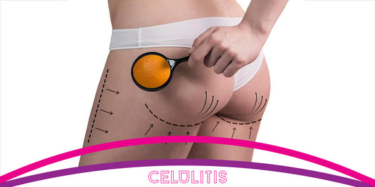 ¿CELULITIS? ACABALA!!!